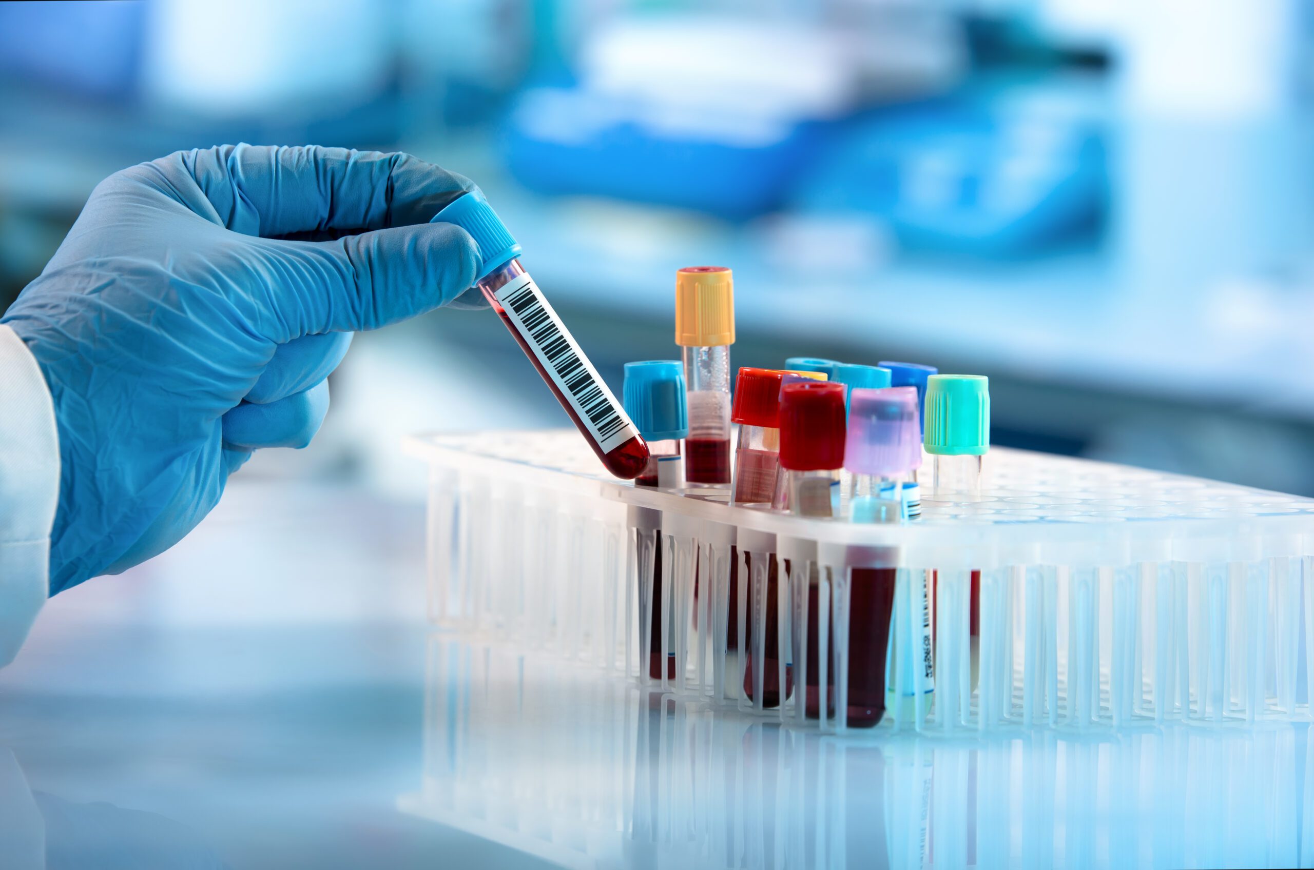 Blutanalysen im eigenen Labor und Fremdlabor
